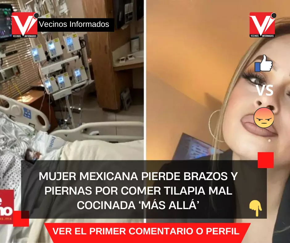 Mujer mexicana pierde brazos y piernas por comer tilapia mal cocinada