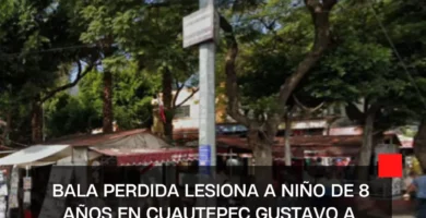 Bala perdida lesiona a niño de 8 años en Cuautepec Gustavo A. Madero