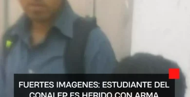 Estudiante del CONALEP es herido con arma blanca en Iztapalapa