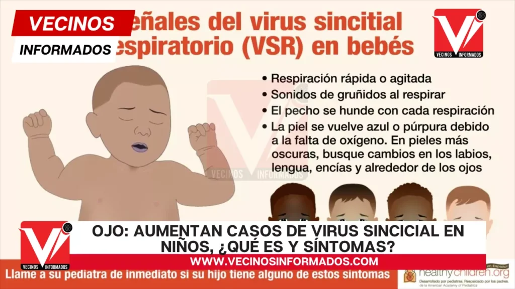 Ojo: Aumentan casos de virus sincicial en niños, ¿qué es y síntomas?
