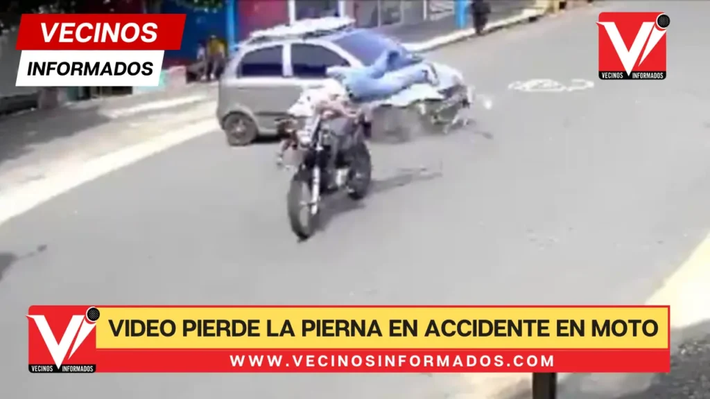 Video sensible: Motociclista pierde su pierna en brutal accidente contra un carro