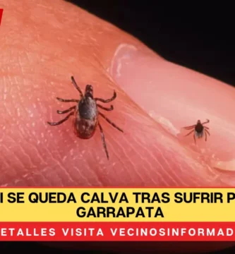 Mujer casi se queda calva tras sufrir picadura de garrapata