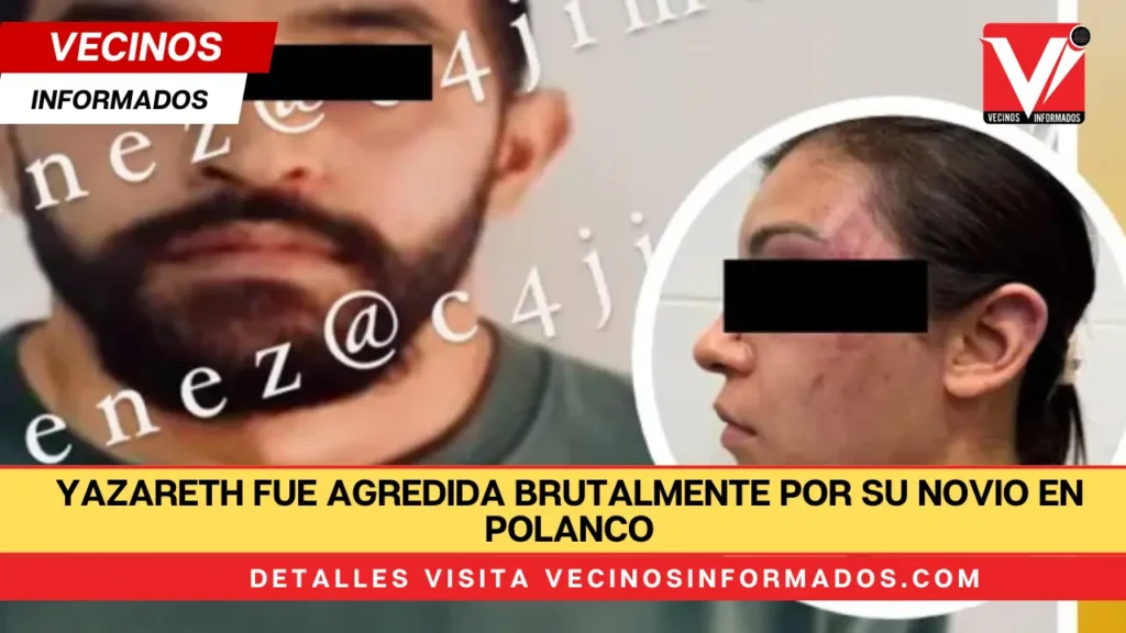 Yazareth fue agredida brutalmente por su novio en Polanco; busca lo imputen por tentativa de feminicidio