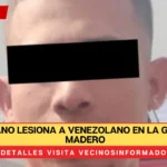 Colombiano lesiona a venezolano en la Gustavo A. Madero