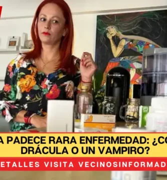 Mexicana padece rara enfermedad: ¿como la de Drácula o un vampiro?