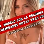 Hallan a modelo con la columna y las extremidades rotas tras fiesta