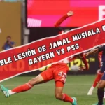 terrible lesión de Jamal Musiala en el Bayern vs PSG